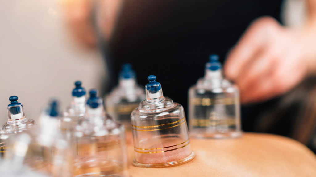 myofascial decompression therapy (cupping)