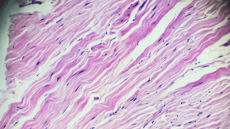 collagen fibers