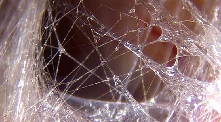 importance of fascia in injury